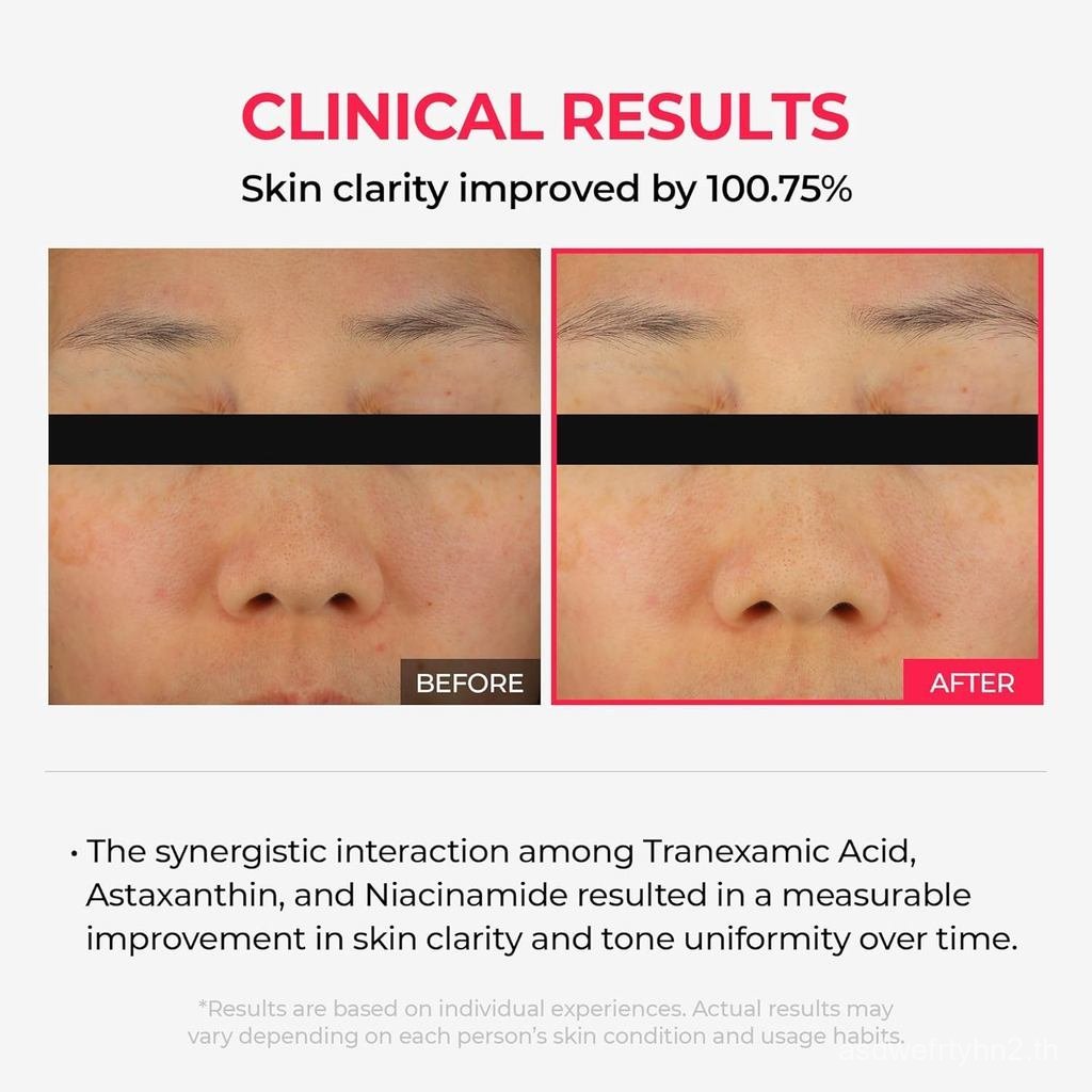 Dr.MelaxinTXAstaxanthinOvernightWrappingPeelMask–ToneImproving,Hydrating&OvernightFaceMaskforGlow&Te