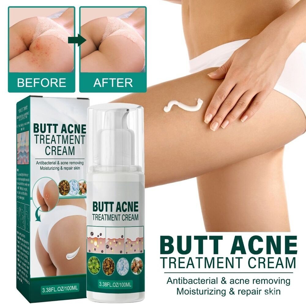 LOVKOR 100ml Butt Pimple Clearing Treatment, Butt Acne Clearing Lotion, Balance Oil Moisturising Ski
