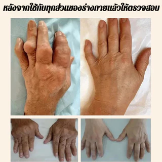 🔥 แผ่นประคบร้อนข้อมือ ให้ความร้อน 3 มิติ ผสานสมุนไพรจิงจูฉ่าย บรรเทาอาการปวดเมื่อย