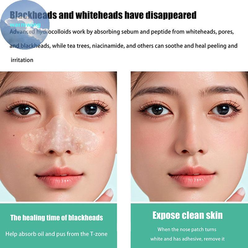Warmwing Pimple Patch Hydrocolloid Patch T-Zone Pore Patch จมูกหน้าผากและคาง Hydrocolloid Patch สําห