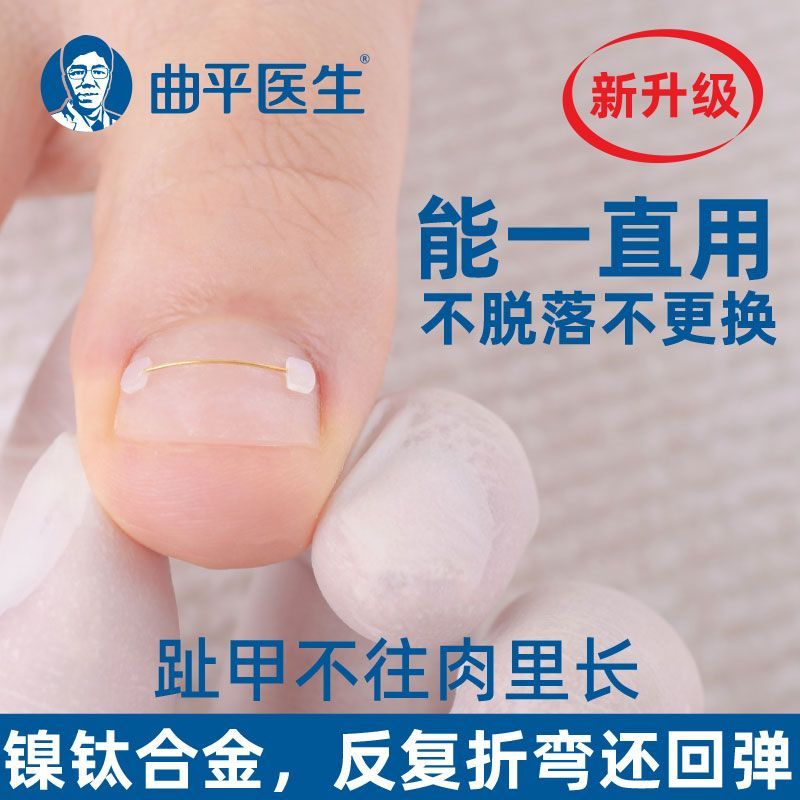 /สินค้าขายดี Qu Pingsheng Jiagou Memory Steel Wire Corrector ของแท้เล็บแพทช์ Toenail Nail Tie Flexit