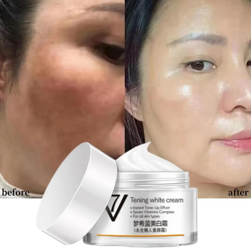Lady V7 Tening White Cream สําหรับจุดด่างดํารอยแผลเป็น Snow White Cream Day Night Cream สําหรับไวท์เ