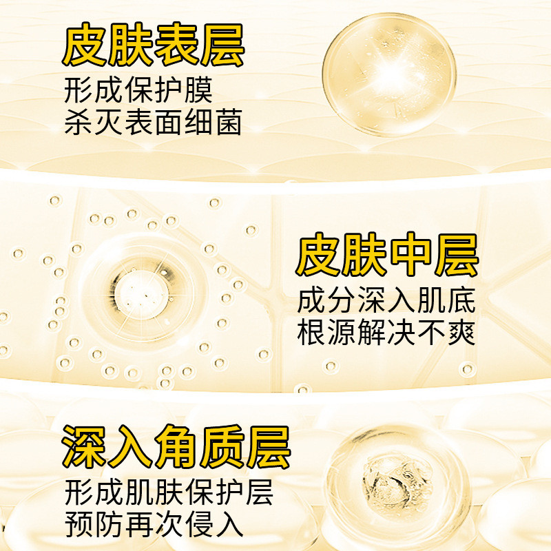 Dongqi Foot Air Spray Foot Odor Foot Sweat Itch Anti-Itch Spray OEM 26.7.11