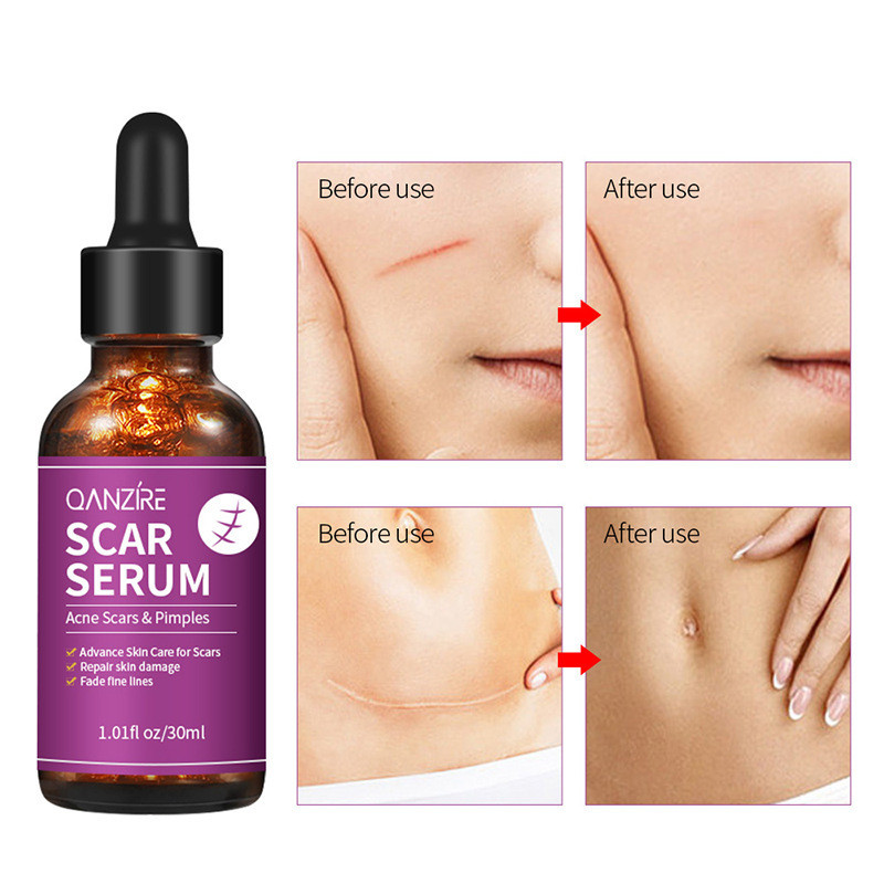Facial Essence Scar Serum Scar Serum Essence Facial Essence Full English AL8+280/07018365