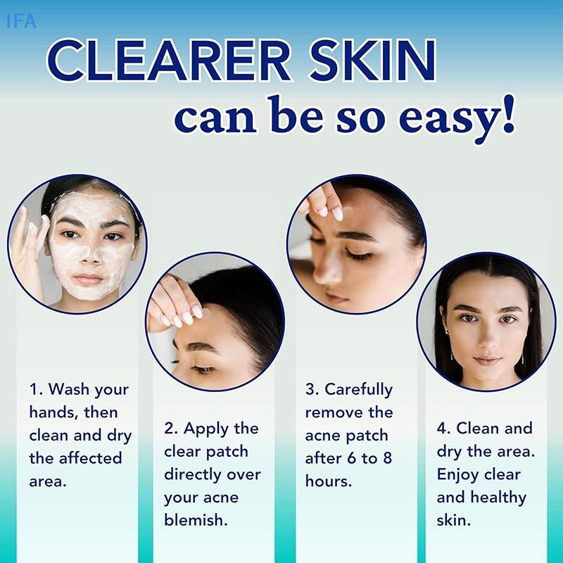 IFA 360pcs Pimple Patch สิวที่มองไม่เห็น Skin Care สติกเกอร์คอนซีลเลอร์ Face Spot เครื่องมือแต่งหน้า