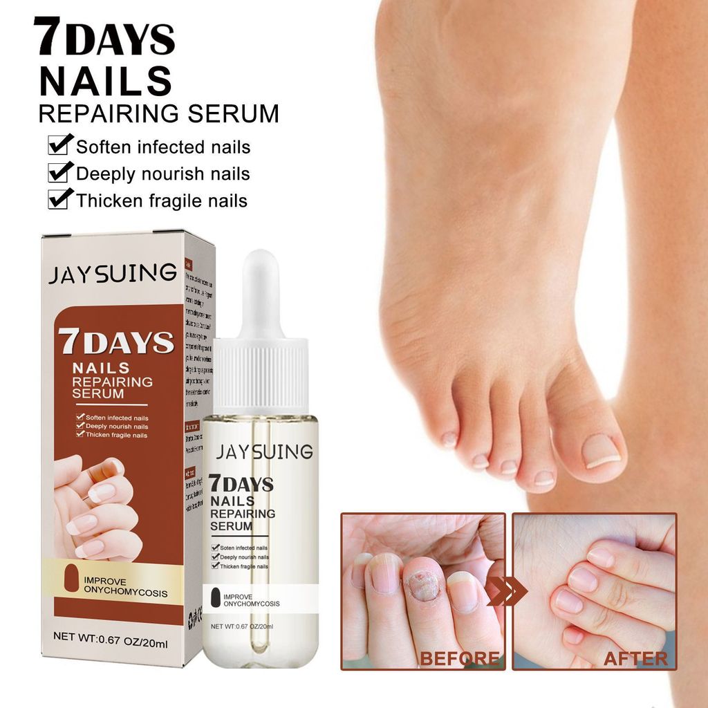 Jaysuing 7 Days Nail Repair Essence Repair เล็บคุดหนา Onychomycosis Hand Foot Nail Repair Lotion8920