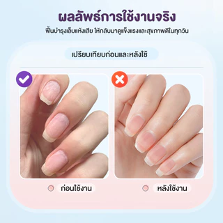 2026 เซรั่มบำรุงเล็บ 3in1 รุ่นใหม่ ปากกาน้ำมันบำรุงเล็บ 3ML โปรตีนไฮโดรไลซ์ พกพาได้