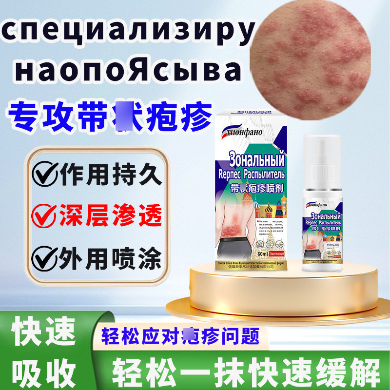 ครีม herpes zoster รัสเซียสําหรับการรักษา sequel 罗斯带  และตัวกรองสําหรับดวงตา 后神杯 ประจําเดือน 外 per e