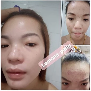 ครีม Lamona ของแท้💯%
