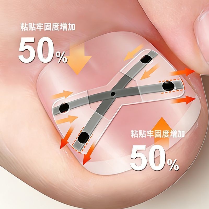 T ไทเทเนียมเล็บ Groove คุดเล็บ Corrector Paronychia Correction Handy เครื่องมือเล็บ Corrector Patch 