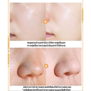 VC โทนเนอร์ ช่วยควบคุมความมัน ช่วยกระชับรูขุมขน หน้าเด้ง กระจ่างใส ด้วย VC โทนเนอร์ วิตามินซีเข้มข้น toner