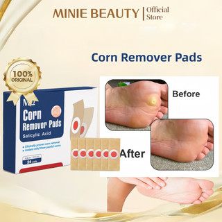 MINIE BEAUTY- 24PCS Corn Removal Patch - Koyo Kaki Ampuh Plester Penghilang Kutil Kapalan Mata Ikan Kapalan Corn Patch Removal Obat Kutil Kapalan Mata Ikan Kaki/Plester Penghilang Kutil Mata Ikan Menghilangkan Kutil