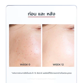 【ลด 50%】SPOTLESS BRIGHTENING GENTLE CLEANSING FOAM 150 G โฟมล้างหน้าผิวกระจ่างใส