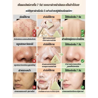 สบู่ล้างหน้าสูตรโบราณ 7 ชนิด น้ํามันมะพร้าวและบาล์ม/สบู่ล้างหน้าความงาม/สบู่ธรรมชาติล้างหน้า【สูตรความงามโบราณ 1000 ปี ช่วยให้ชุ่มชื้น】 น้ํามันมะพร้าวออร์แกนิก/บาล์มธรรมชาติจากพืช/ไม่มีสารเคมีอันตราย | ผิวหมองคล้ําไม่กระจ่างใส/ส