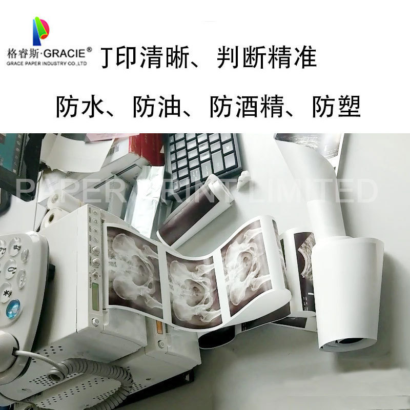 Thermal B Super Paper UPP-110S กระดาษพิมพ์ความร้อน, กระดาษ B Super, กระดาษ A6 Video B Super