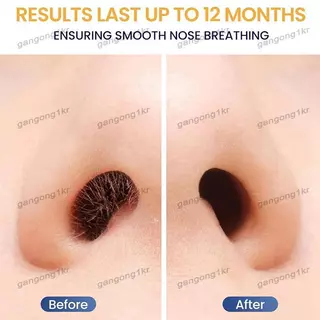 [gangong1kr]แท่งขี้ผึ้งจมูก 100 ชิ้น, เครื่องสมัครแว็กซ์ผมพร้อมไม้พายแบบใช้แล้วทิ้งสําหรับทําความสะอาดรูจมูก, กําจัดขนใบหน้าหู