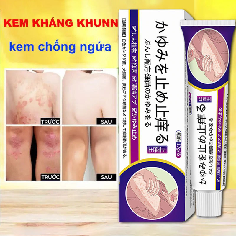 Japanese Anti-Itch King Skin Cream Anti-Itch Anti-Itch Anti-Itch Anti-Itch Anti-Itch Anti-Itch Anti-