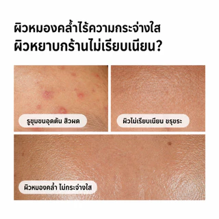 The Ordinary Glycolic Acid 7% Toning Solution 240ml โทนเนอร์ผลัดผิว ผิวใส Glow Skin ลดหมองคล้ำ ผิวเรียบเนียน