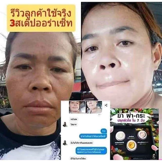 🍃✨ครีมรักษาสิว ฝ้า กระ #3สเต็ป ออร่าหน้าใส✨🍃