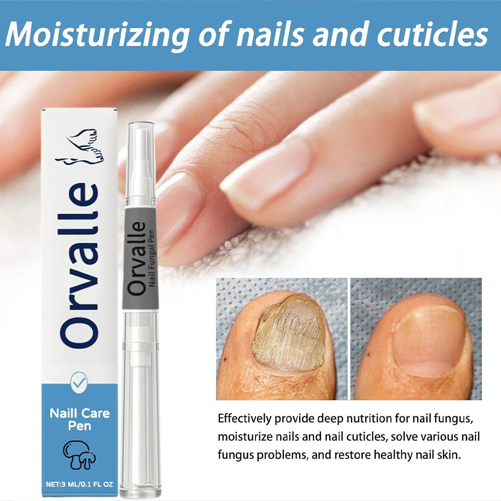 Orville Nail Fungus Pen 1 Pieces Nail Care Repair Pen 3ml