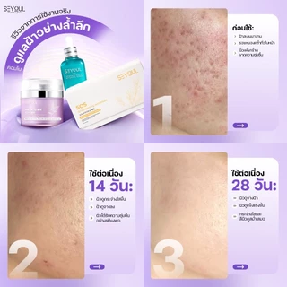 🌙 เซ็ตกู้ผิวคนนอนดึกครบ 4 สเต็ป จาก SEYOUL – Cleanser + Advanced Serum + Night Cream + SOS Ampoule