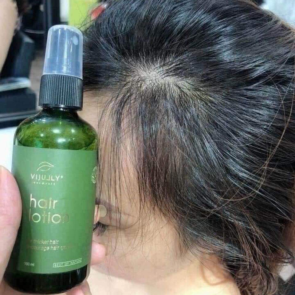 Xit buoi vijilly tri rung toc kich moc toc101522วีเค