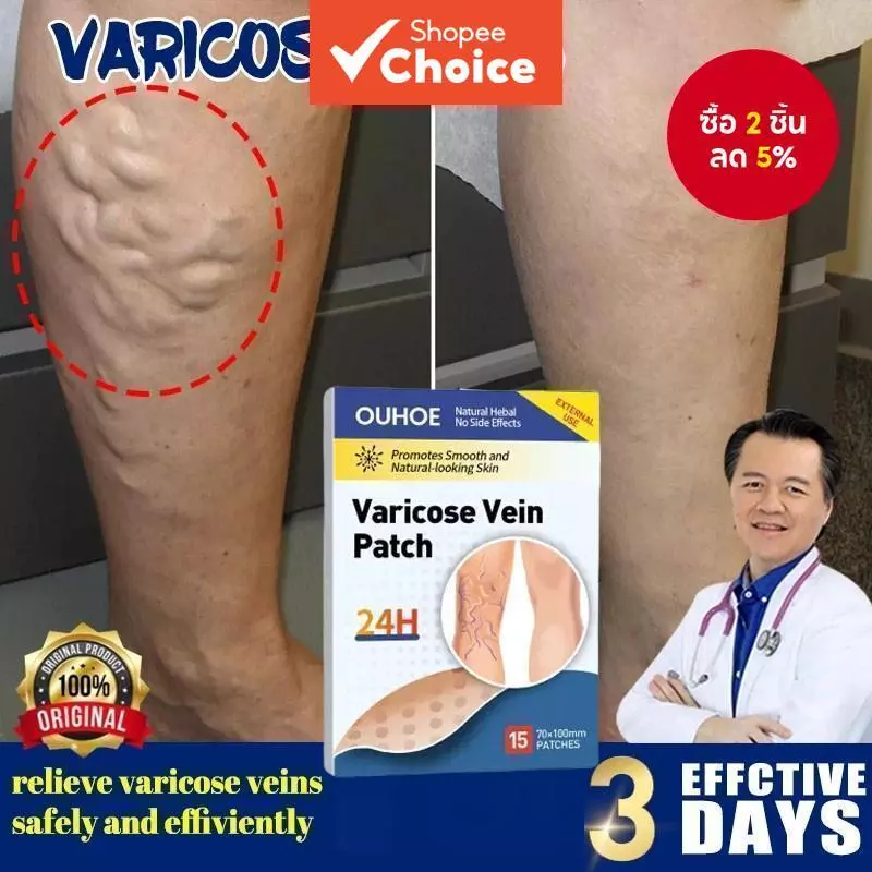 แผ่นแปะรักษาเส้นเลือดขอด Varecose Vein Remover ช่วยส่งเสริมการไหลเวียนโลหิต - 28793503672