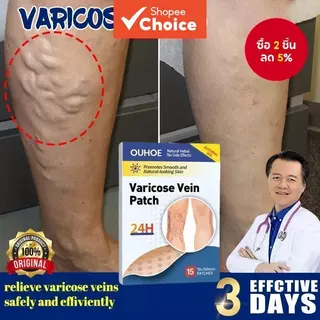 แผ่นแปะรักษาเส้นเลือดขอด Varecose Vein Remover ช่วยส่งเสริมการไหลเวียนโลหิต - 28793503672