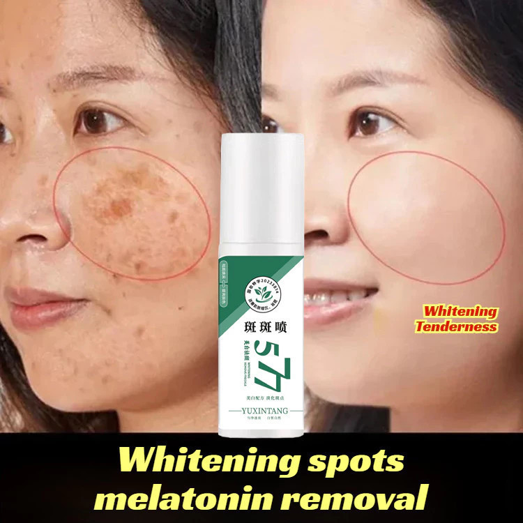 X4B2 8MK7 Brightening Spray Spot Removal Essence Anti-Aging Essence Skin Care Spot Fading Essence
