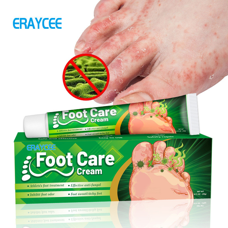 ERAYCEE Cross-Border สมุนไพรเท้า QI ครีมเท้ากลิ่น Care ครีมคันเท้าเท้าเท้า QI เท้าภายนอกใช้ครีม 20g