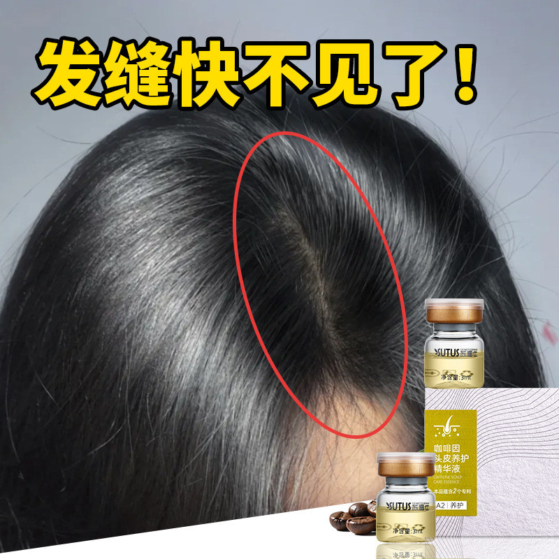 920 Caffeine Care Hair Tonic Water Suto Anti-shedding Hair Tonic Scalp Scalp Care Essence Miaohetang