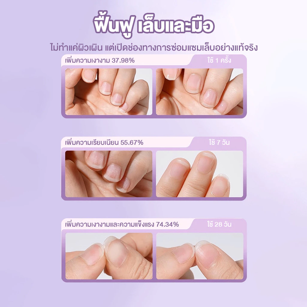 3in1ปากกาเอสเซนส์เล็บ ปากกาน้ำมันบำรุงเล็บ ผิวที่ตายแล้ว มีน้ำมันบำรุงเล็บ บำรุงเล็บให้ชุ่มชื้น การซ่อมแซมเล็บ thumbnail 8