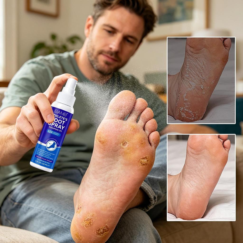 Athlete Foot Spray Itch Relief Quick-Drying Liquid 120ml Peeling Athlete Foot Spray huizoth