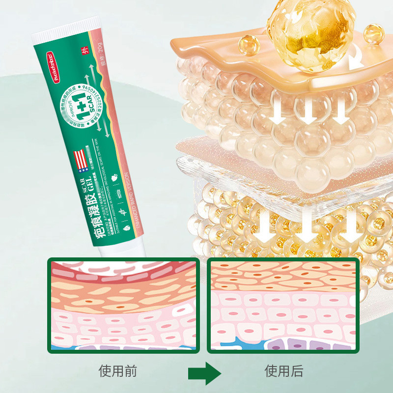 เจลรอยแผลเป็นอุปกรณ์ Skin Care II Repair Moisturizing Scars Surgery Smoothing Gel Scars