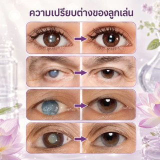 ครีมบำรุงรอบดวงตาต่อต้านริ้วรอย ช่วยลดรอยคล้ำใต้ตา ขจัดอาการบวมและถุงใต้ตา ทำให้บริเวณรอบดวงตาสว่างขึ้น