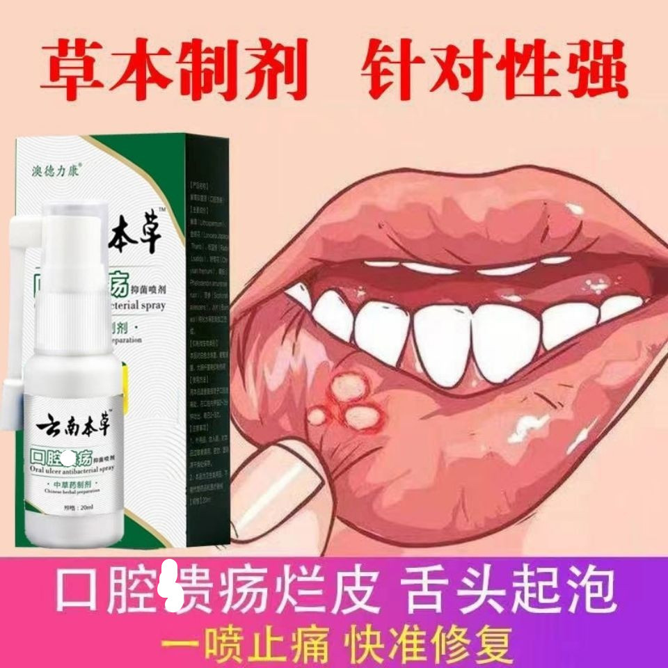 Yunnnan Materia Medica Oral Ulcer Spray Fire on the Mouth Bad Breath Odor Foaming Bad Odor Oral Tong