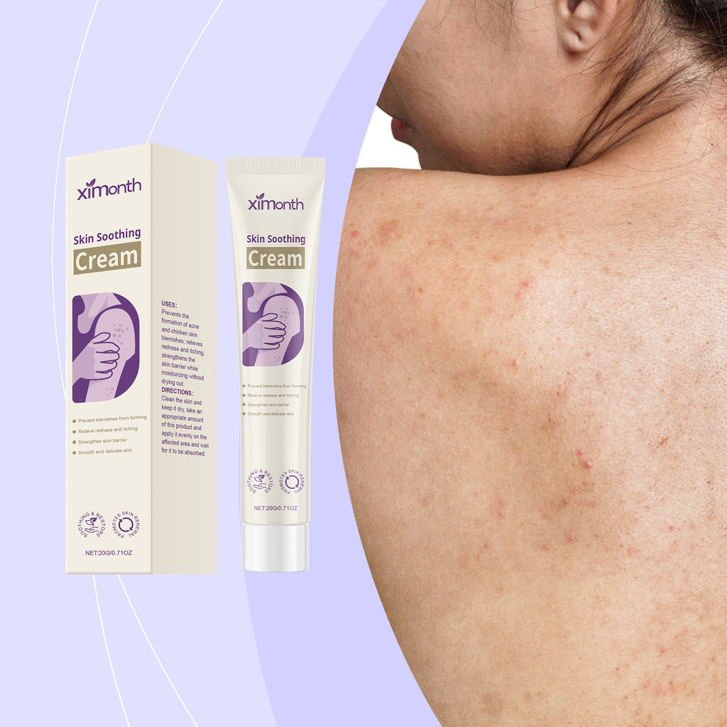 [คลังสินค้าพร้อม] XIMONTH Skin Comfort Cream Skin Discomfort Herbal Care Smooth Skin Care Cream WJG