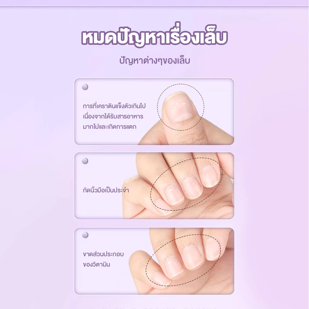 3in1ปากกาเอสเซนส์เล็บ ปากกาน้ำมันบำรุงเล็บ ผิวที่ตายแล้ว มีน้ำมันบำรุงเล็บ บำรุงเล็บให้ชุ่มชื้น การซ่อมแซมเล็บ thumbnail 3