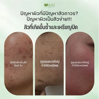 LUXE GIRL WithUpure เจลแต้มสิว สูตรสมุนไพรและวิตามินซี ช่วยบำรุงและเสริมเกราะป้องกันใบหน้า 50ml