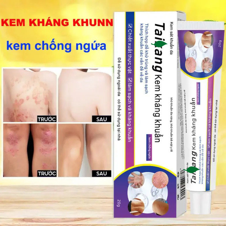 Japanese Anti-Itch King Skin Cream Anti-Itch Anti-Itch Anti-Itch Anti-Itch Anti-Itch Anti-Itch Anti-