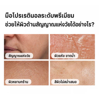 The Ordinary Retinol 1% in Squalane 30ml เซรั่มเรตินอล ลดเลือนริ้วรอย ผิวเรียบเนียน ดูอ่อนเยาว์ ลดริ้วรอย