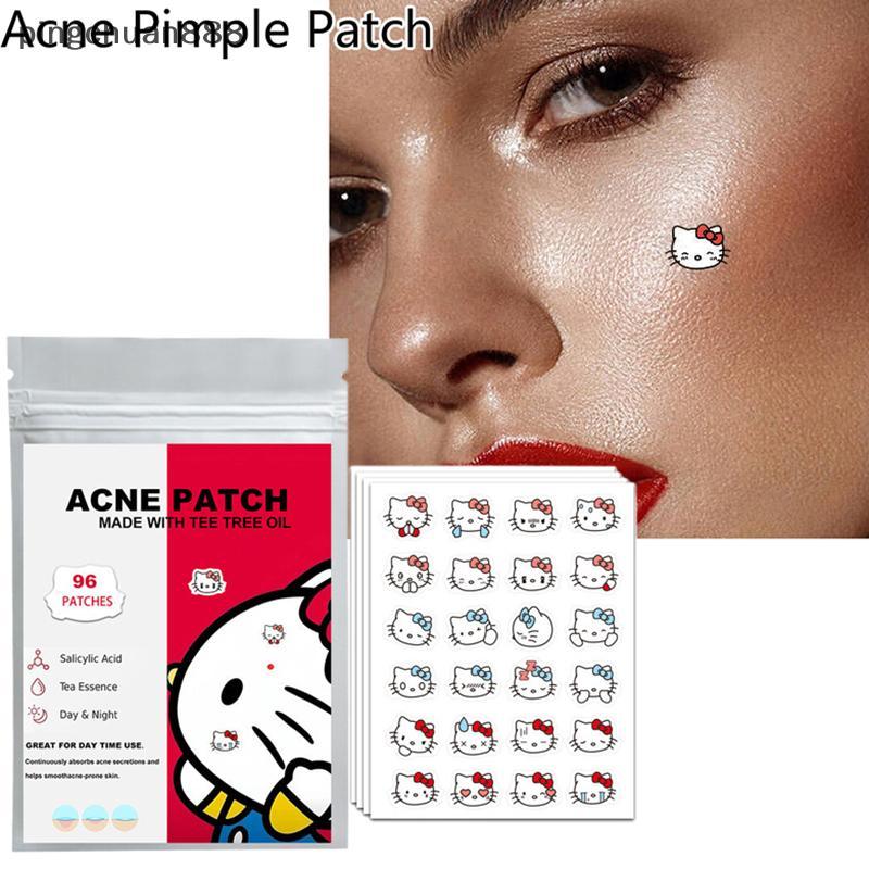 Pingchuan888 96 ชิ้น Hello Kitty Cat Repair Acne Patch บํารุงผิวหน้า Fade Blemishes Pimple Nice