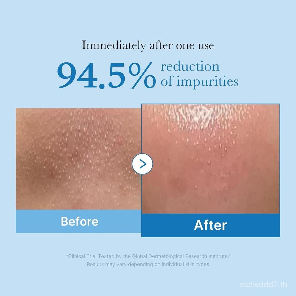 MedicubeZeroPorekheadOil|แต่งหน้าRemoverforalltypes,DailyMoistureFacialCleanser,Low-Irrtation|Korean