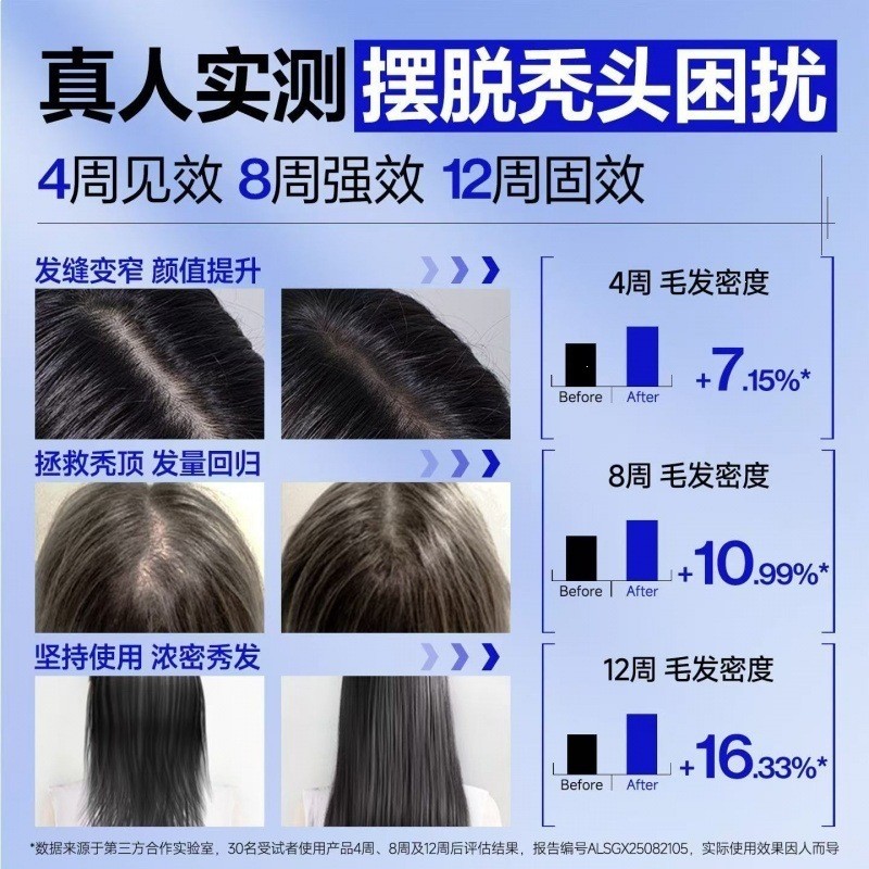 ขายร้อน EHD Anti-shedding Shampoo Oil Control Anti-Dandruff Fluffy Soft Nourishing Anti-breaking Str