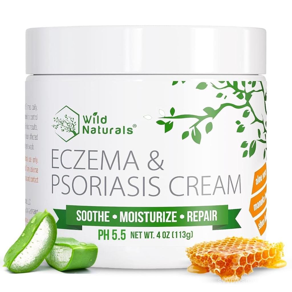 Wild Naturals Eczema & Psoriasis Cream for Dry, Itchy Skin – Eczema Relief for Adults & Kids – Moist