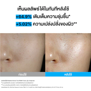 [ใหม่!] Innisfree Retinol Green Tea PDRN Skinbooster Toner 170ml. เรตินอล พีดีอาร์เอ็น โทนเนอร์ 170มล. น้ำตบผิวกระจก