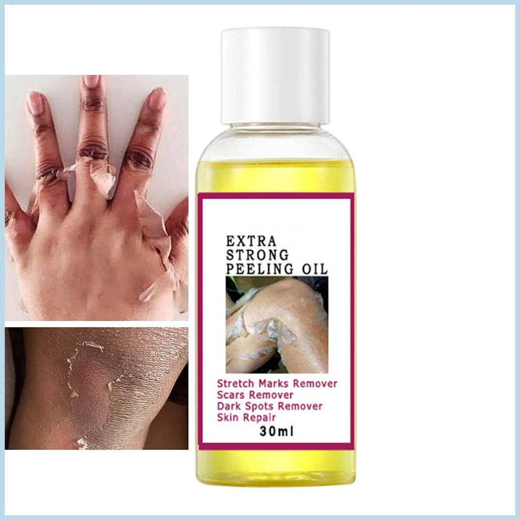 Skin Peeling Oil Ordinary Peeling Solution Moisturizing Peeling Solution Brightening สําหรับผิวส่วนใ