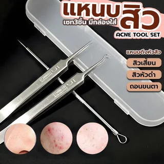 แหนบสิว 3 ชิ้นพร้อมกล่องเก็บ กำจัดสิวหัวดำ สิวเสี้ยน และสิวอุดตันได้อยู่หมัด เหมาะทั้งใช้เองและในร้านเสริมสวย