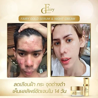 ครีมลดฝ้า ไนท์ครีมแฟร์รี่โกลด์ night cream fairygold/ ครีมกลางคืนแฟร์รี่โกลด์ lot.12