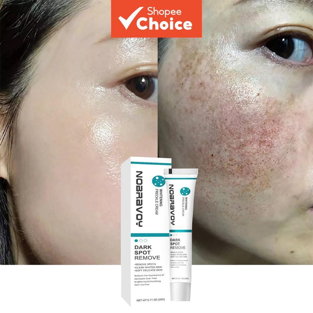 Dark Spot Cream For Face & Body Corrector ขจัดฝ้ากระ Sun Spot รอยดํา 20g